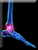 Ankle