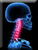 Neck
